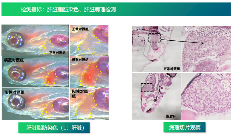 酒精性与非酒精性脂肪肝防护功效评价