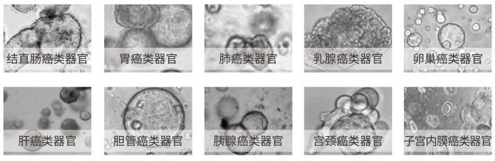 类器官构建及生物样本库建立